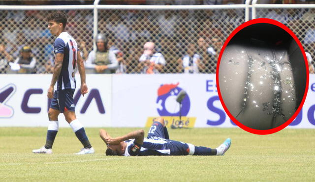 Alianza Lima le ganó 2-1 a Atlético Grau pese a que tuvo 2 lesionados en los primeros minutos. Foto: GLR