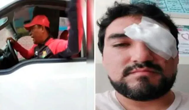 Agraviado tuvo que ser operado de la vista y estuvo a milímetros de quedar ciego tras el ataque. Foto: ATV - Video: "ATV noticias"