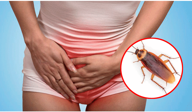 Los doctores se sorprendieron al descubrir una cucaracha en la vagina de la fémina. Foto: composición LR/BBC News Mundo/20Minutos
