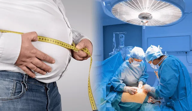Según los expertos, las personas pueden adelgazar entre 25 y 45 kilos con la cirugía de manga gástrica. Foto: composición LR/ClínicaEndoObesidad/Infosalus