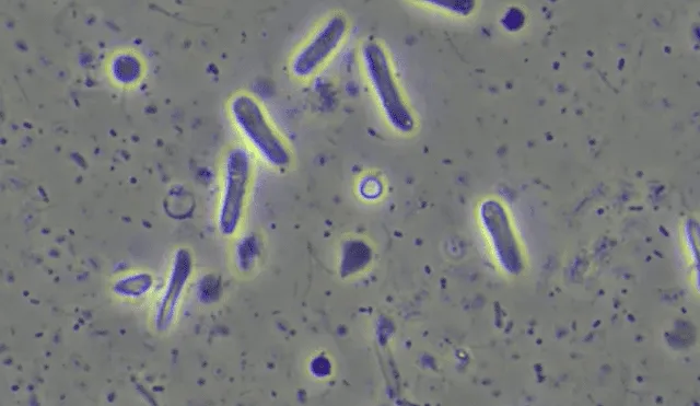 Las bacterias resistentes a los medicamentos son consideradas una "gran preocupación sanitaria a nivel mundial". Foto: microscopes