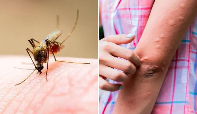 Generalmente, las picaduras de mosquitos producen hinchazón y picazón. Foto: composición LR/difusión/Freepik