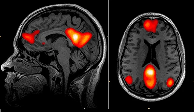 Esta IA identifica sustancias químicas vinculadas con la enfermedad de Parkinson. Foto: referencial