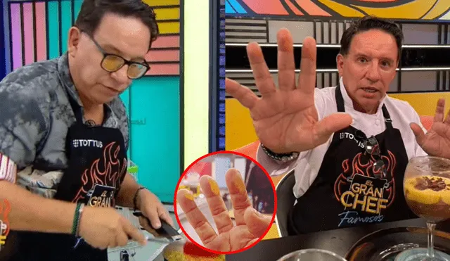 Ricardo Rondón no dudó en mostrar sus dedos luego de varias quemaduras en "El gran chef: famosos". Foto: composición LR/ @RicardoRondon/Twitter
