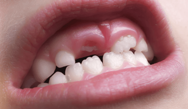 Aprueban los ensayos clínicos en humanos de un fármaco que podría regenerar dientes. Foto: Oral Care Club
