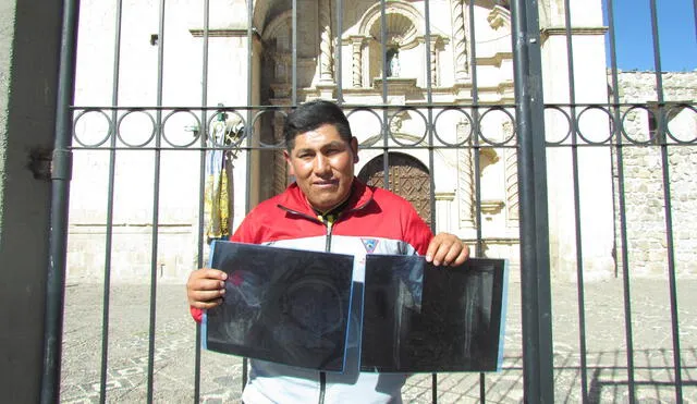 Diego Quispe muestra radiografías que registran disparos. Foto: La República