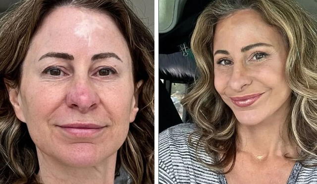 La mujer mencionó que vendió su casa para hacerme un estiramiento facial y parece 20 años más joven. Foto: composición LR/@rvchickadee/Instagram