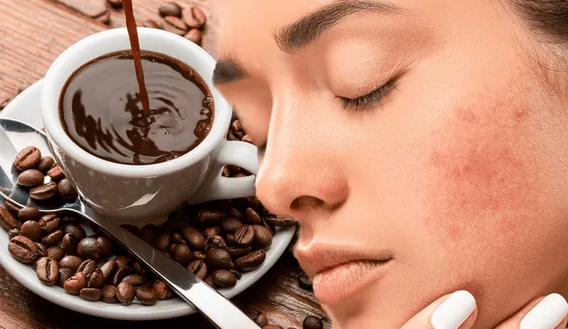 El café puede aumentar la respuesta al estrés y este es capaz de activar un brote de acné. Foto: composición/Minimalist/difusión