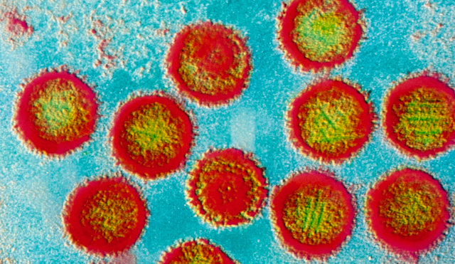 Imagen microscópica de virus VEB. Foto: Science Source