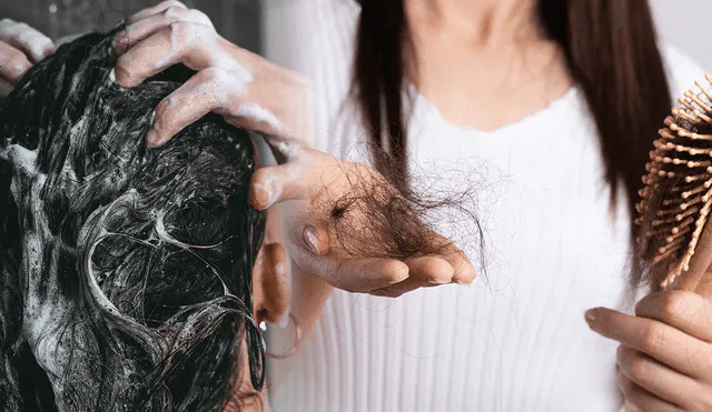 También existen tratamientos para prevenir la caída del cabello. Foto: composición/Glamor México/difusión