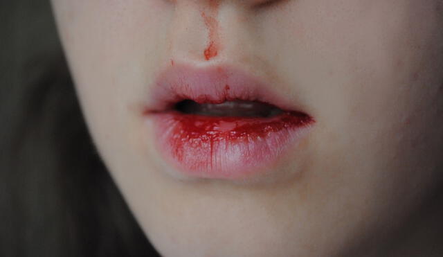 Estos son los significados que puede tener soñar que a alguien le sale sangre por la boca. Foto: WallHere