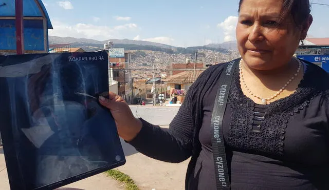 Madre presentó la radiografía a las cámaras. Foto: Luis Álvarez Guevara/La República