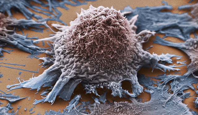 En un gran avance para la ciencia, científicos lograron convertir tumores cancerosos en músculo. Foto: referencial/Anne Weston, The Francis/Science