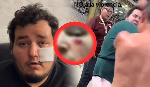 Hincha de la 'U' denunció que fue agredido por otros fanáticos de Universitario. Foto: composición LR/captura de Instagram
