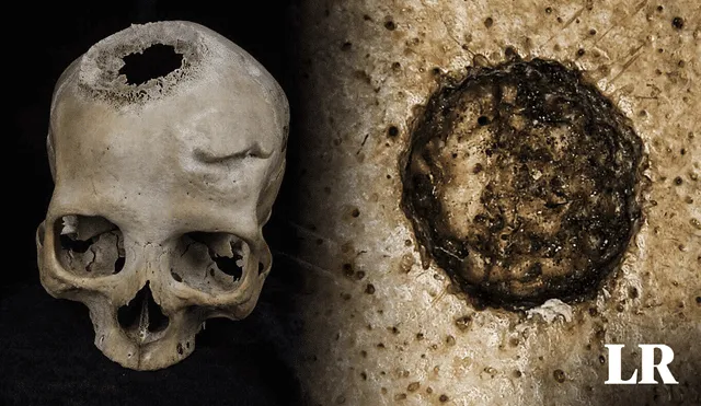 Científicos españoles examinaron un cráneo egipcio de 4.000 años de antigüedad. Evidencias apuntan a que fue operado por un tumor. Foto: composiciónLR/Fabrizio Oviedo/Frontiers in Medicine/Tondini, Isidro, Camarós