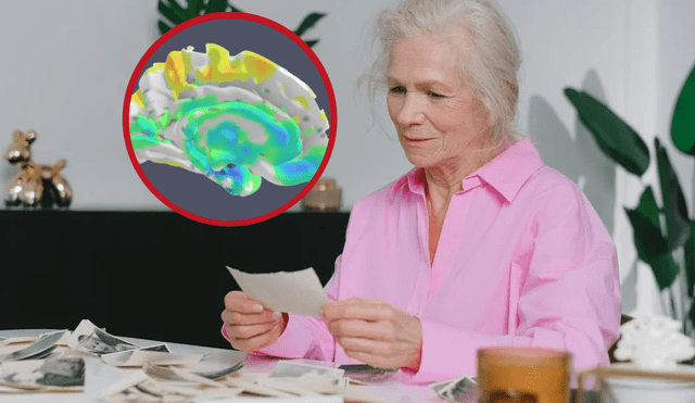 LANS avanza más lentamente que el Alzheimer. Foto: composición LR / Mayo Clinic / Pexels