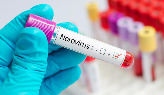 El norovirus es una de las principales causas de enfermedades gastrointestinales en los Estados Unidos. Foto: USA Today