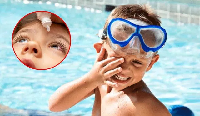 La conjuntivitis es una afección frecuente en verano que puede evitarse con medidas de higiene y prevención adecuadas. Foto: composición LR