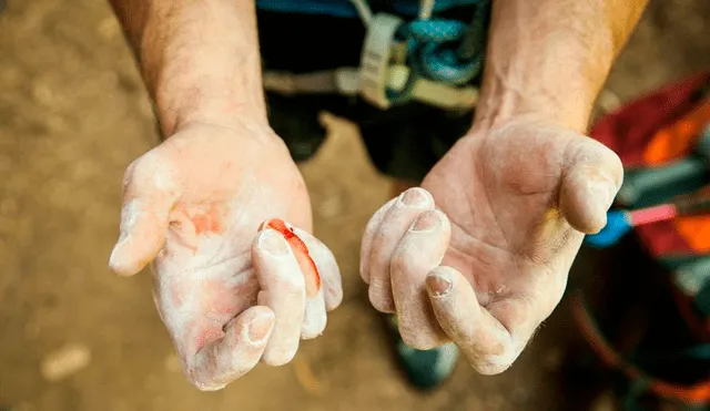 Soñar con sangre es, en realidad, una experiencia bastante habitual. Foto: difusión