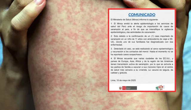Alerta epidemiológica Ministerio de Salud. Foto: composición La República/ Minsa Alerta epidemiológica Ministerio de Salud. Foto: composición La República/ Minsa