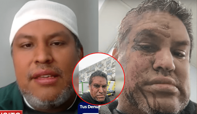 Pese a encontrarse malherido por la agresión que sufrió por ciudadanos chilenos, el peruano relató que los paramédicos se negaron a atenderlo a tiempo. Foto: composición LR/24 Horas Pese a encontrarse malherido por la agresión que sufrió por ciudadanos chilenos, el peruano relató que los paramédicos se negaron a atenderlo a tiempo. Foto: composición LR/24 Horas