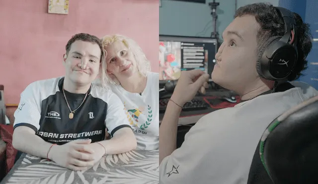 Tomás Ricardi fue diagnosticado con leucemia, un hongo mucormicótico le comió su rostro y puso su vida en riesgo a los 15 años. Foto: TN Tomás Ricardi fue diagnosticado con leucemia, un hongo mucormicótico le comió su rostro y puso su vida en riesgo a los 15 años. Foto: TN