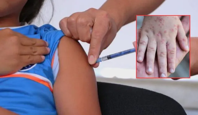 Personal médico aplica vacuna SRP en campaña contra el brote de sarampión. Personal médico aplica vacuna SRP en campaña contra el brote de sarampión.