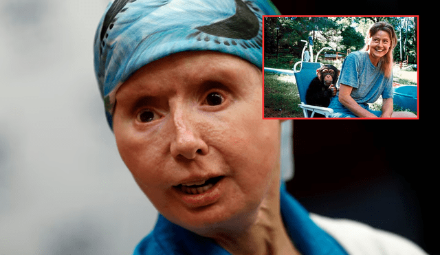 Charla Nash sufrió la pérdida de los párpados, los labios, la mandíbula y la nariz a causa del chimpancé de una amiga. Foto: Composición LR/ The Guardian Charla Nash sufrió la pérdida de los párpados, los labios, la mandíbula y la nariz a causa del chimpancé de una amiga. Foto: Composición LR/ The Guardian