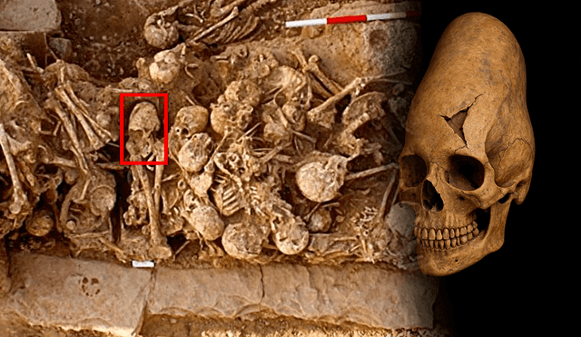 El milenario cráneo tiene al rededor de 6 mil millones de años de antigüedad revela una modificación craneal tradicional. Foto: Composición LR/ Zohreh Prehistoric Project