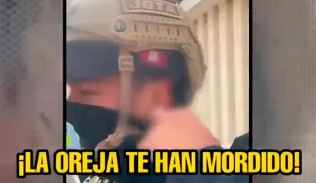 Ambulante mordió a trabajador municipal Ambulante mordió a trabajador municipal