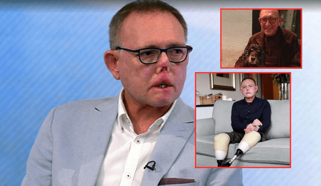 Jaco Nel sufrió la pérdida de sus piernas, dedos de una mano y parte de su rostro tras el arañazo y lamida de su perro Harvey. Foto: Composición LR/ BBC/ Instagram de Jaco Nel/ Cambridge News Jaco Nel sufrió la pérdida de sus piernas, dedos de una mano y parte de su rostro tras el arañazo y lamida de su perro Harvey. Foto: Composición LR/ BBC/ Instagram de Jaco Nel/ Cambridge News