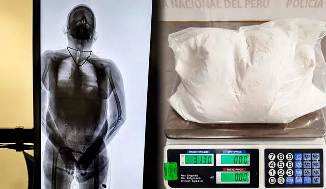 Escáner corporal evidenció bultos extraños en el torso y extremidades del pasajero que alertó a autoridades del aeropuerto Jorge Chávez. Escáner corporal evidenció bultos extraños en el torso y extremidades del pasajero que alertó a autoridades del aeropuerto Jorge Chávez.
