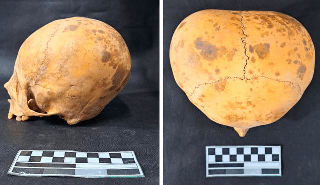 El cráneo de un niño que murió hace casi 800 años fue hallado por trabajadores durante una excavación. Foto: Ministerio de Cultura de Catamarca El cráneo de un niño que murió hace casi 800 años fue hallado por trabajadores durante una excavación. Foto: Ministerio de Cultura de Catamarca