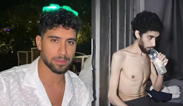 Evyatar David, el joven israelí secuestrado por Hamás, luce irreconocible tras meses en cautiverio. Evyatar David, el joven israelí secuestrado por Hamás, luce irreconocible tras meses en cautiverio.