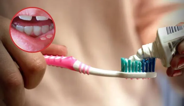 ¿Qué causa el fluoruro de estaño? El compuesto presente en 14 pastas dentales en Perú que el Digemind alertó como riesgoso ¿Qué causa el fluoruro de estaño? El compuesto presente en 14 pastas dentales en Perú que el Digemind alertó como riesgoso