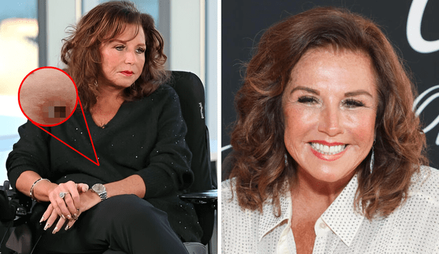 Abby Lee Miller says she has had a catheter for years and sues the hospital for improper procedure. Photo: GLR Composition/Daily Mail/MSN Abby Lee Miller says she has had a catheter for years and sues the hospital for improper procedure. Photo: GLR Composition/Daily Mail/MSN