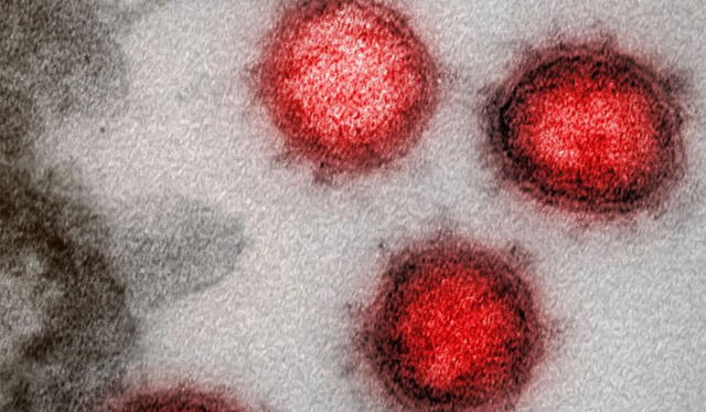 Imagen del coronavirus obtenida con microscopio electrónico. Crédito: NIAID.