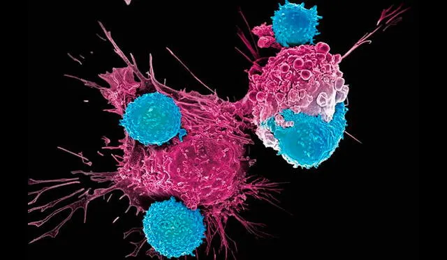 Estos glóbulos blancos identifican y destruyen las células cancerosas. Imagen: Difusión.