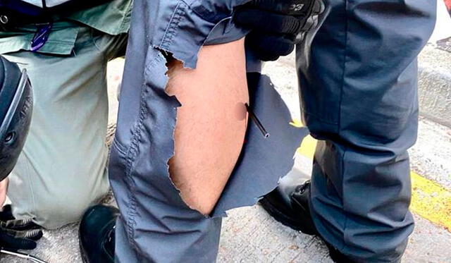 Los policías muestran al agente herido por una de las flechas. Foto: EFE.