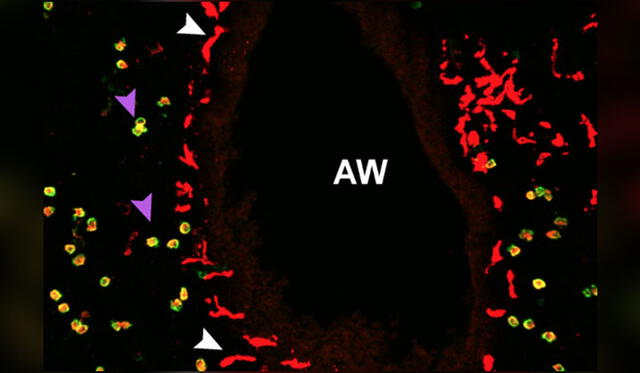 Una captura de las vías respiratorias (AW), donde se observa a los macrófagos AM (flechas moradas) y los NAM (flechas blancas). Crédito: Science Immunology.