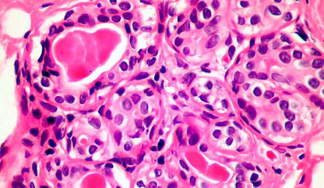 La idea es aumentar el número de estas células para combatir los diversos tipos de cáncer. Imagen: Science Photo Library.