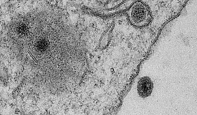 Imagen ampliada del Yaravirus. Fuente: BioRXiv. Imagen ampliada del Yaravirus. Fuente: BioRXiv.