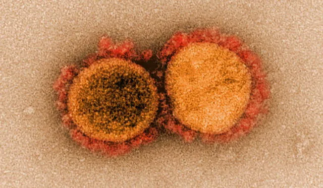 Partículas del coronavirus aisladas de una persona infectada. Imagen: NIH.