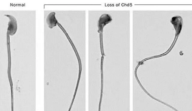 Un anterior estudio determinó que la proteína Cdh5 era la encargada de empaquetar la información genética. El espermatozoide de la derecha no posee Cdh5.