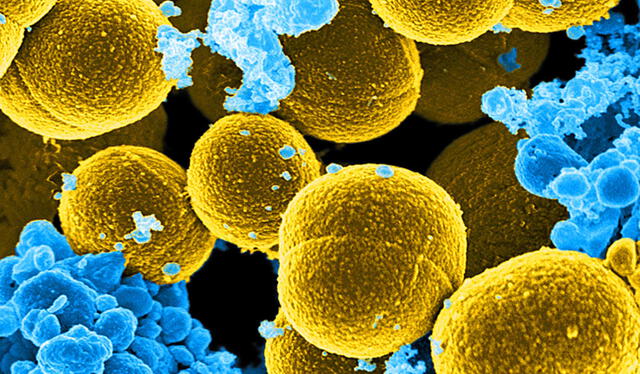 Imagen de microscopia electrónica digitalmente colorida que muestra bacterias Staphylococcus. Foto: referencial / Instituto Nacional de Alergias y Enfermedades Infecciosas (NIAID)