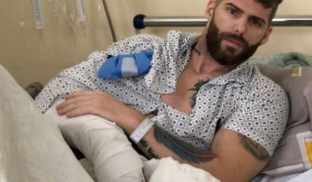 Greg Michel tras la primera operación a su brazo. Foto: Sebastián Lizarzaburu/ Instagram
