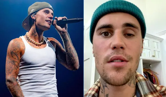 El cantante Justin Bieber sorprendió a más de uno al revelar que padece de esta enfermedad. Foto: justinbieber/Instagram