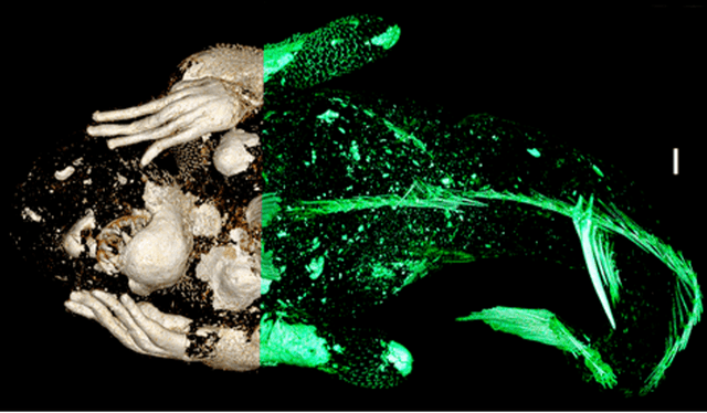  Reconstrucción digital de la 'momia sirena' que muestra diferentes capas del cuerpo. Foto: KUSA    