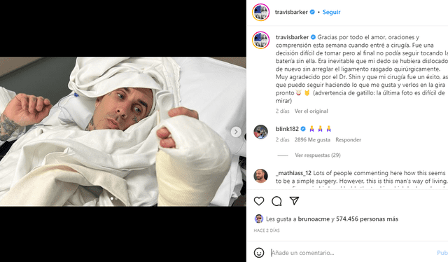  Travis Barker se muestra en redes tras ser operado. Foto: captura/ Instagram   