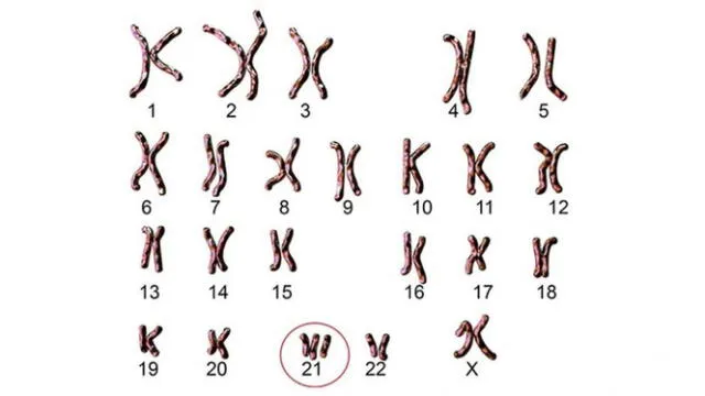 Material genético extra. Se forman 3 cromosomas en el par 21. Foto: Shutterstock   